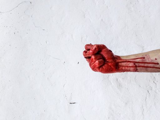 Nekaj je gnilega v deželi Sloveniji primer odrezane roke in vpogled v kartoteko Milojke Kolar Celarc